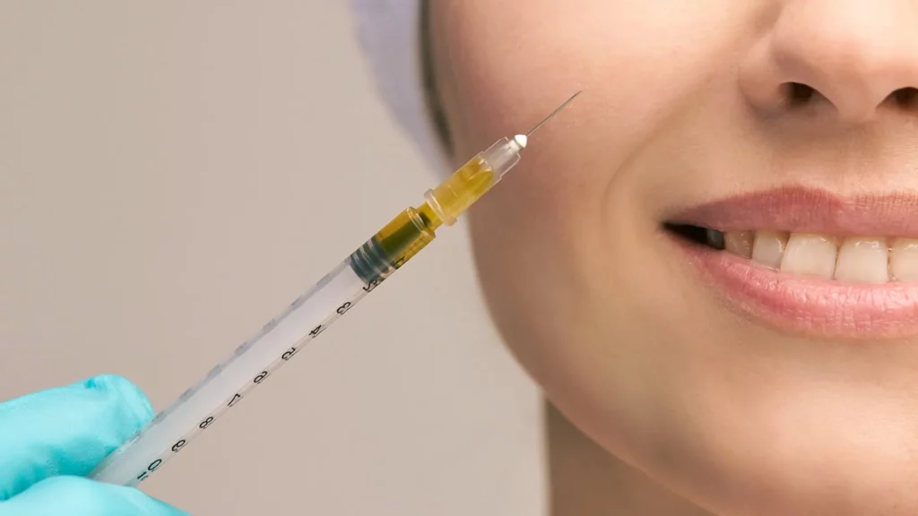 PRP Derma-fill